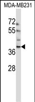 1 - EMID1 Antibody (N-term) AP13509a