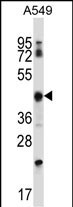 1 - KRT37 Antibody (Center) AP13514c