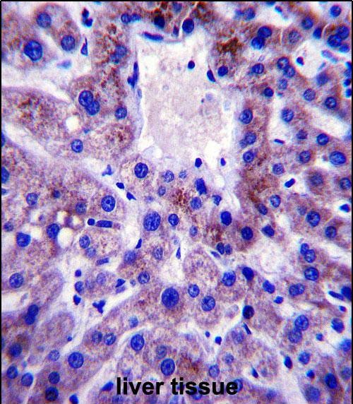 14 - UBE2W Antibody (C-term) AP13607b