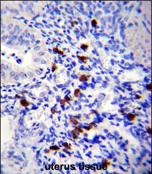 14 - TNN Antibody (Center) AP13618C