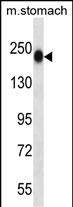 1 - TNN Antibody (Center) AP13618C