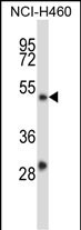 1 - YY2 Antibody (C-term) AP13666b