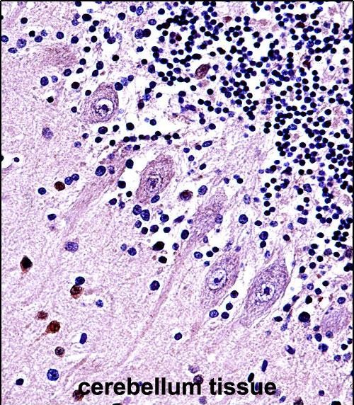 14 - TRPC5 Antibody (N-term) AP13769A