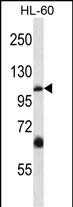 1 - TRPC5 Antibody (N-term) AP13769A