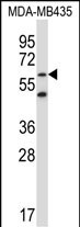 1 - ZNF479 Antibody (N-term) AP13882a