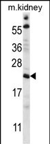 1 - TTC33 Antibody AP15007a