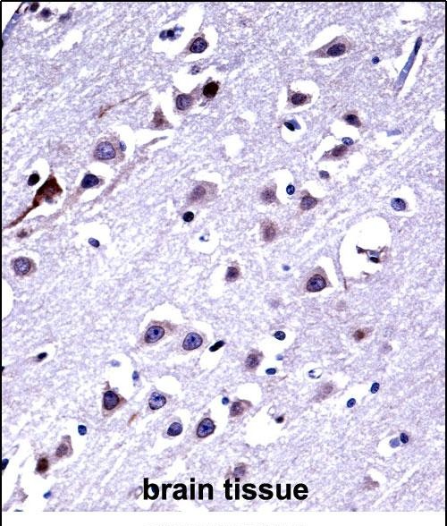 14 - KIF16b Antibody AP15010A