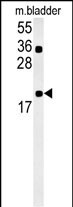 1 - CCDC12 Antibody (N-term) AP13962a