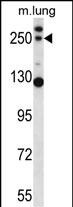 1 - C4B Antibody (Center) AP13985c