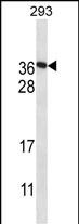 1 - F122A Antibody (Center) AP14015c