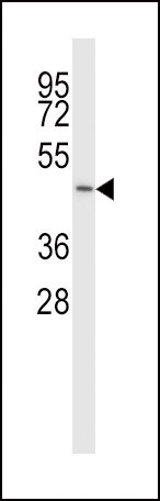 1 - SLC38A5 Antibody (N-term) AP14098A