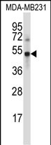 1 - UBP46 Antibody (C-term) AP14161b