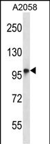 1 - TMC6 Antibody (N-term) AP14212a
