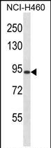 1 - RGS9 Antibody (N-term) AP14236a