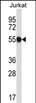 1 - CNOT2 Antibody (Center) AP14239c