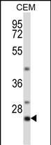 1 - LIME1 Antibody (C-term) AP14247b