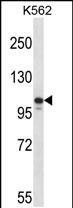 1 - Mouse Jak3 Antibody (N-term) AP14261a