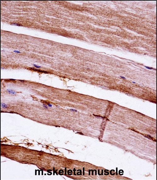 14 - Mouse Mapkapk3 Antibody (N-term) AP14268a