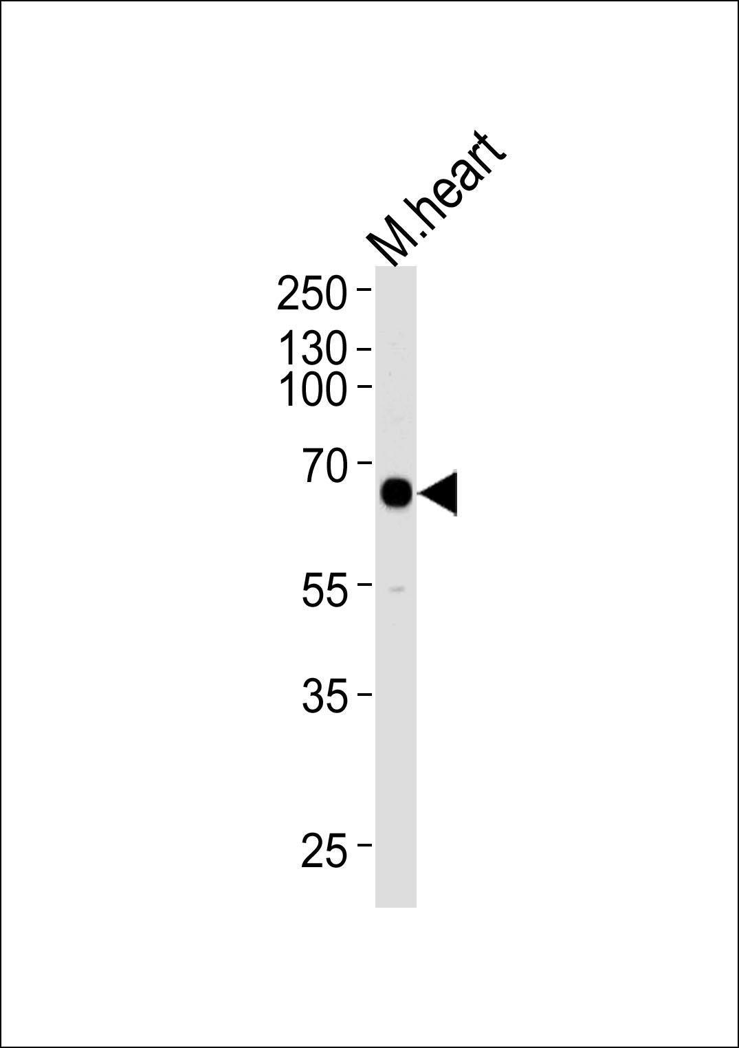 1 - Mouse Mapkapk3 Antibody (N-term) AP14268a