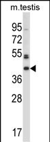 1 - Mouse Sgk196 Antibody (C-term) AP14296b