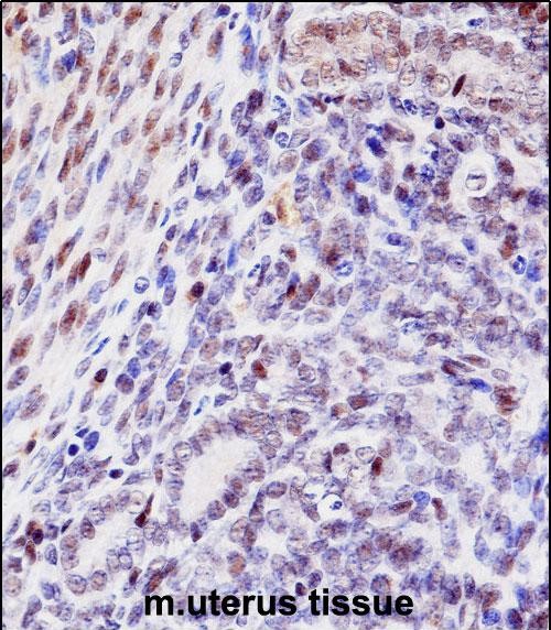 14 - Mouse Hoxd10 Antibody (Center) AP14309C