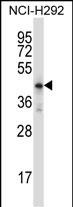 1 - Mouse Hoxd10 Antibody (Center) AP14309C
