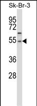 1 - PPM1A Antibody AP14313a