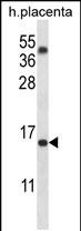 1 - TM4SF18 Antibody (Center) AP14327c