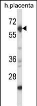 1 - Mouse Nrbp2 Antibody (C-term) AP14333b