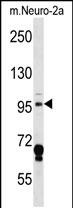 1 - Mouse Map4k3 Antibody (Center) AP14443C