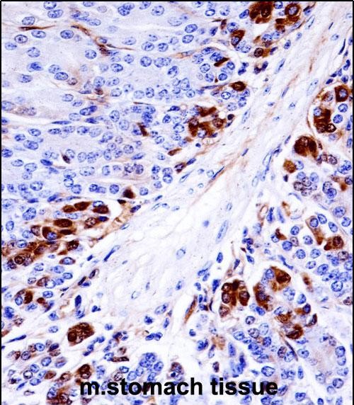 14 - Mouse Mapkapk5 Antibody (N-term) AP14447a