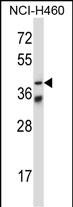 1 - Mouse Mapkapk5 Antibody (N-term) AP14447a
