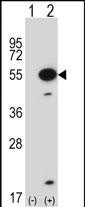 1 - Mouse Mapkapk5 Antibody (N-term) AP14447a