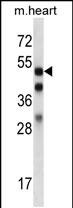 1 - Mouse Mapkapk5 Antibody (N-term) AP14447a
