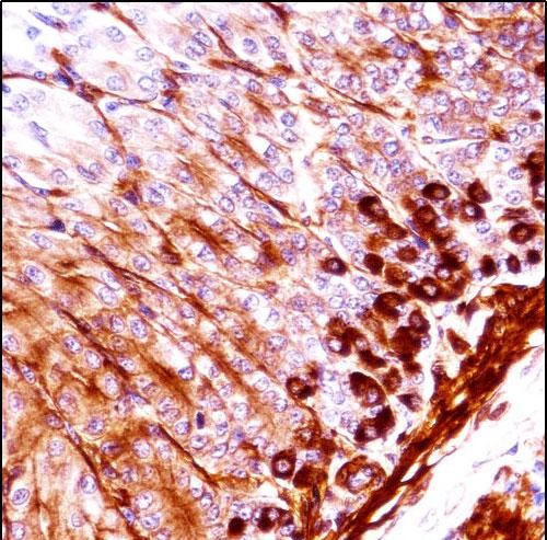 14 - Mouse Nek5 Antibody (C-term) AP14449b