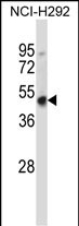 1 - Mouse Hoxd3 Antibody (C-term) AP14466b