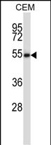 1 - Mouse Styk1 Antibody (Center) AP14469c