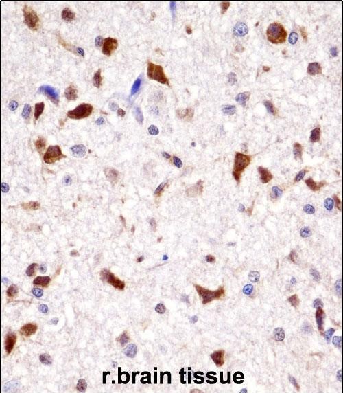 14 - Rat Hoxa7 Antibody (N-term) AP14474a