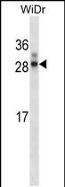 1 - Rat Hoxa7 Antibody (N-term) AP14474a