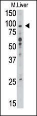 1 - TLR6 Antibody (C-term) AP1506A