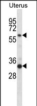 1 - FAM172A Antibody (Center) AP14487c
