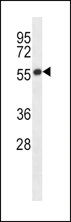 1 - GABRB2 Antibody (C-term) AP14538b