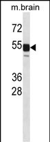 1 - Mouse Clk1 Antibody (N-term) AP14613a