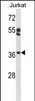 1 - OVOL1 Antibody (N-term) AP14637a