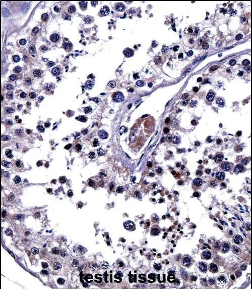 14 - IL25 Antibody (Center) AP14661c