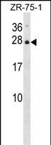 1 - IL25 Antibody (Center) AP14661c