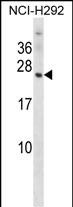 1 - OMP Antibody (N-term) AP14664a