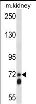 1 - APLP2 Antibody (C-term) AP14673b