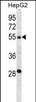 1 - TMPRSS13 Antibody (C-term) AP14675b