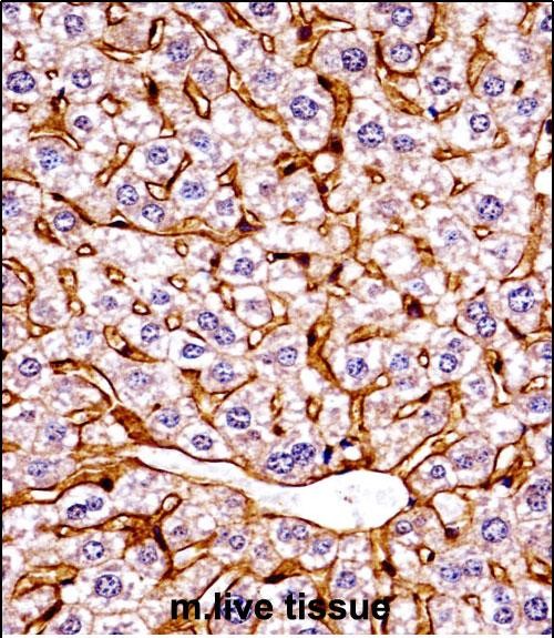 14 - Mouse Eif2ak4 Antibody (C-term) AP14713b